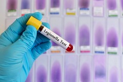 RSA, alberghi e B&B, campagna di prevenzione anti-Legionella di ASL Bari