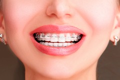 L'ortodonzia è importante su tutto il corpo