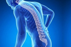 Osteoartrosi: quando il dolore diventa movimento. La sfida della prevenzione e della riabilitazione