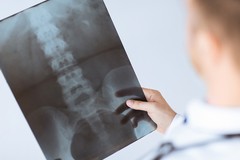 Cura delle ossa e patologie osteoarticolari, incontro a Corato