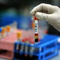 Coronavirus, salgono a 320 i casi positivi in Puglia