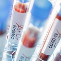 Coronavirus, 77 nuovi contagi e 9 decessi in Puglia