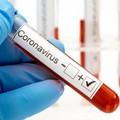 Coronavirus, 762 nuovi casi positivi in Puglia. 10 i decessi