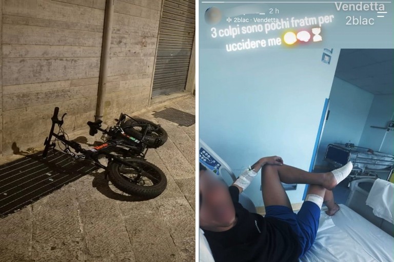 Prima la lite, poi i colpi di pistola. Ferito un 23enne: «Tre colpi sono pochi»