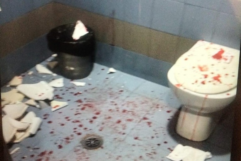 Sangue nei bagni della stazione FBN di Corato: interviene la scientifica